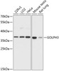 Western blot analysis of extracts of various cell lines using GOLPH3 Polyclonal Antibody at dilution of 1:3000.