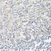 Immunohistochemistry of paraffin-embedded Human tonsil using MUL1 Polyclonal Antibody at dilution of  1:100 (40x lens).