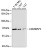 Western blot analysis of extracts of various cell lines using CDK5RAP3 Polyclonal Antibody at dilution of 1:3000.