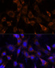 Immunofluorescence analysis of NIH-3T3 cells using VPS25 Polyclonal Antibody at dilution of  1:100 (40x lens). Blue: DAPI for nuclear staining.