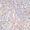Immunohistochemistry of paraffin-embedded Human appendix using CTSG Polyclonal Antibody at dilution of  1:100 (40x lens).