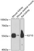 Western blot analysis of extracts of various cell lines using KLF10 Polyclonal Antibody at dilution of 1:3000.