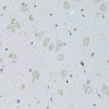 Immunohistochemistry of paraffin-embedded Rat brain using SLC29A1 Polyclonal Antibody at dilution of  1:100 (40x lens).