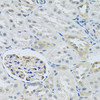 Immunohistochemistry of paraffin-embedded Rat kidney using SLC29A1 Polyclonal Antibody at dilution of  1:100 (40x lens).