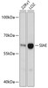 Western blot analysis of extracts of various cell lines using SIAE Polyclonal Antibody at dilution of 1:3000.