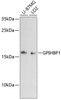 Western blot analysis of extracts of various cell lines using GPIHBP1 Polyclonal Antibody at dilution of 1:3000.