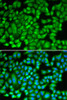 Immunofluorescence analysis of A549 cells using KAT5 Polyclonal Antibody
