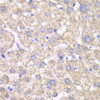 Immunohistochemistry of paraffin-embedded Human liver damage using ACAT1 Polyclonal Antibody at dilution of  1:100 (40x lens).