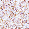 Immunohistochemistry of paraffin-embedded Rat ovary using ACAT1 Polyclonal Antibody at dilution of  1:100 (40x lens).