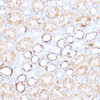 Immunohistochemistry of paraffin-embedded Mouse kidney using ACAT1 Polyclonal Antibody at dilution of  1:100 (40x lens).