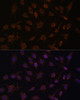 Immunofluorescence analysis of C6 cells using ACAT1 Polyclonal Antibody at dilution of  1:100. Blue: DAPI for nuclear staining.