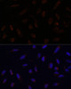 Immunofluorescence analysis of U-2 OS cells using ACAT1 Polyclonal Antibody at dilution of  1:100. Blue: DAPI for nuclear staining.