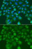 Immunofluorescence analysis of A549 cells using CST1 Polyclonal Antibody