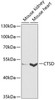 Western blot analysis of extracts of various cell lines using CTSD Polyclonal Antibody at dilution of 1:1000.