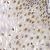 Immunohistochemistry of paraffin-embedded Human esophagus using DDX5 Polyclonal Antibody at dilution of  1:100 (40x lens).