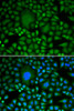 Immunofluorescence analysis of HeLa cells using DDX5 Polyclonal Antibody