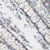 Immunohistochemistry of paraffin-embedded Human colon using DHODH Polyclonal Antibody at dilution of  1:200 (40x lens).