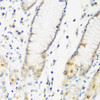 Immunohistochemistry of paraffin-embedded Human stomach using DHODH Polyclonal Antibody at dilution of  1:200 (40x lens).