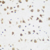 Immunohistochemistry of paraffin-embedded Mouse brain using DHODH Polyclonal Antibody at dilution of  1:200 (40x lens).
