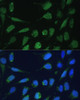 Immunofluorescence analysis of U-2 OS cells using DLST Polyclonal Antibody at dilution of  1:100 (40x lens). Blue: DAPI for nuclear staining.