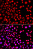 Immunofluorescence analysis of A549 cells using HLX Polyclonal Antibody