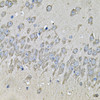 Immunohistochemistry of paraffin-embedded Mouse brain using PRKAB2 Polyclonal Antibody at dilution of  1:100 (40x lens).