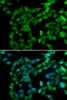 Immunofluorescence analysis of U2OS cells using PRKAB2 Polyclonal Antibody