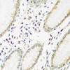 Immunohistochemistry of paraffin-embedded Human stomach using PYCR1 Polyclonal Antibody at dilution of  1:200 (40x lens).