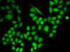 Immunofluorescence analysis of MCF-7 cells using RANGAP1 Polyclonal Antibody