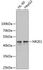 Western blot analysis of extracts of various cell lines using NR2E1 Polyclonal Antibody at dilution of 1:1000.