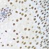 Immunohistochemistry of paraffin-embedded Human esophagus using XRCC5 Polyclonal Antibody at dilution of  1:100 (40x lens).