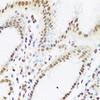 Immunohistochemistry of paraffin-embedded Human stomach using XRCC5 Polyclonal Antibody at dilution of  1:100 (40x lens).