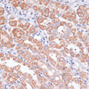 Immunohistochemistry of paraffin-embedded Human stomach using MBTPS1 Polyclonal Antibody at dilution of  1:100 (40x lens).