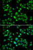 Immunofluorescence analysis of U2OS cells using MBTPS1 Polyclonal Antibody