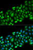 Immunofluorescence analysis of HeLa cells using RIPK2 Polyclonal Antibody