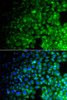 Immunofluorescence analysis of A549 cells using USP10 Polyclonal Antibody