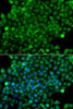 Immunofluorescence analysis of A549 cells using CFHR3 Polyclonal Antibody