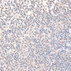 Immunohistochemistry of paraffin-embedded Human appendix using ZNF346 Polyclonal Antibody at dilution of  1:100 (40x lens).