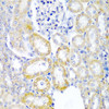 Immunohistochemistry of paraffin-embedded Rat kidney using UPF2 Polyclonal Antibody at dilution of  1:200 (40x lens).