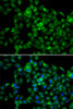 Immunofluorescence analysis of A549 cells using NAT8B Polyclonal Antibody