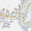 Immunohistochemistry of paraffin-embedded Rat lung using Cytochrome c Polyclonal Antibody at dilution of  1:100 (40x lens).