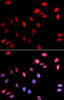 Immunofluorescence analysis of U2OS cells using RAD18 Polyclonal Antibody