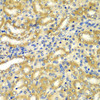 Immunohistochemistry of paraffin-embedded Mouse kidney using GOPC Polyclonal Antibody at dilution of  1:100 (40x lens).