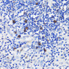Immunohistochemistry of paraffin-embedded Human appendix using TET3 Polyclonal Antibody at dilution of  1:200 (40x lens).