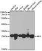Western blot analysis of extracts of various cell lines using AK4 Polyclonal Antibody at dilution of 1:1000.