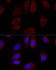 Confocal immunofluorescence analysis of U2OS cells using AK4 Polyclonal Antibody at dilution of  1:100. Blue: DAPI for nuclear staining.