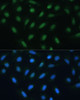 Immunofluorescence analysis of U-2 OS cells using ATF3 Polyclonal Antibody at dilution of  1:100. Blue: DAPI for nuclear staining.