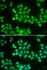 Immunofluorescence analysis of HeLa cells using CHD2 Polyclonal Antibody