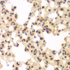 Immunohistochemistry of paraffin-embedded Rat lung using CSNK2A2 Polyclonal Antibody at dilution of  1:100 (40x lens).