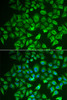 Immunofluorescence analysis of A549 cells using EHHADH Polyclonal Antibody